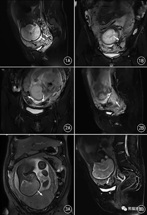 1534845935230435.jpg 圖1.webp.jpg