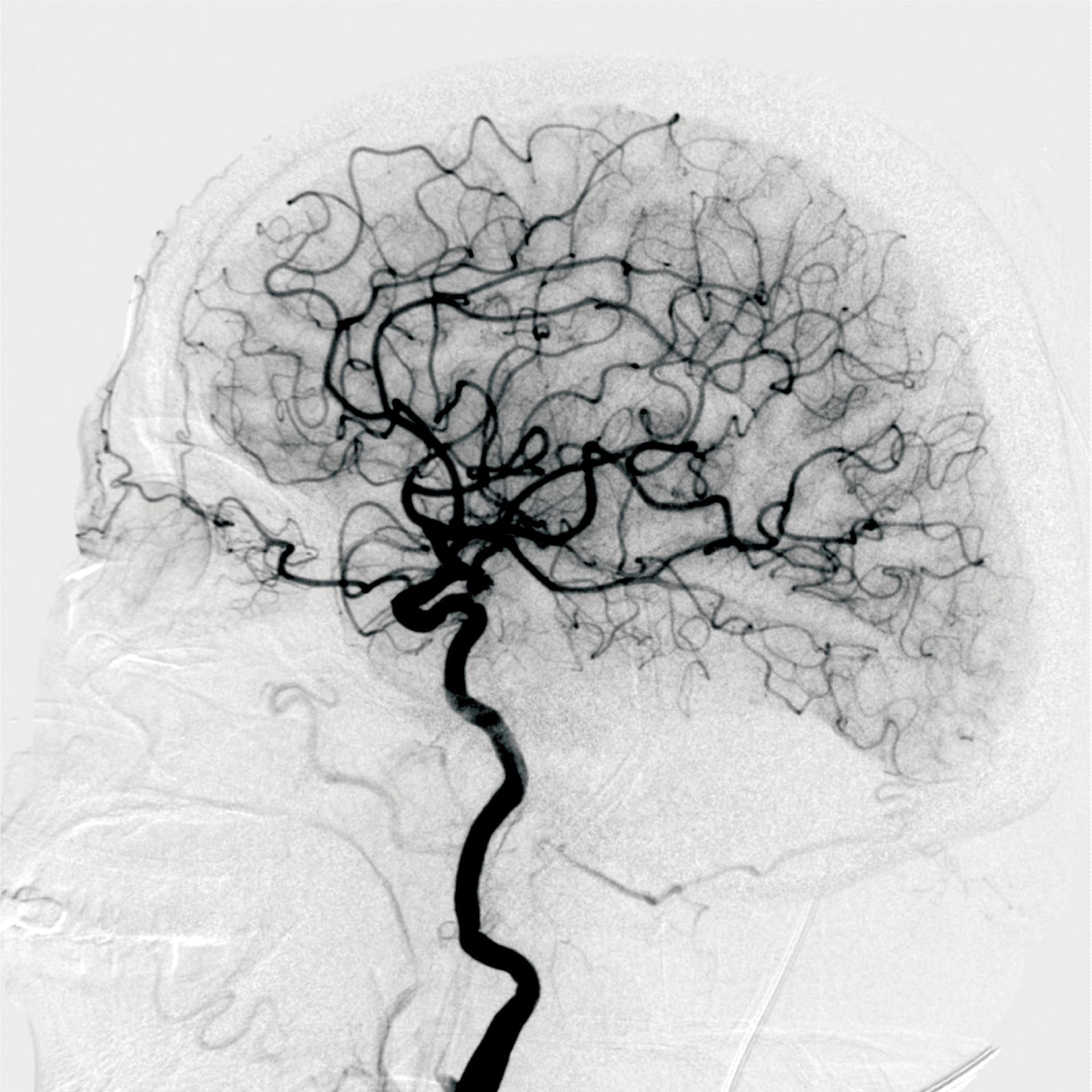 1615958420907411.jpg 1615958420907411.jpg